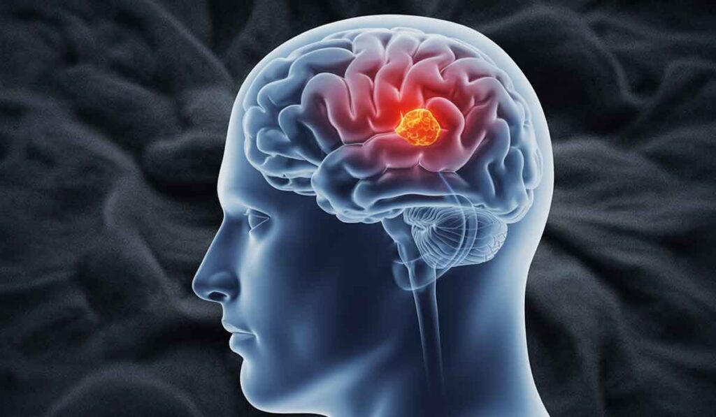 Illustration of a human brain in profile with a highlighted red area indicating a tumor or abnormal growth inside the brain.